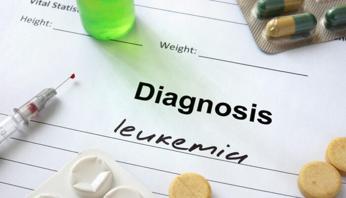 Acute Myeloid Leukemia – Stages, Types, Symptoms, Causes, and Therapies