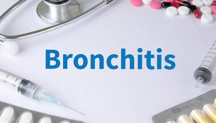 Bronchitis – Top Remedies and Management Options