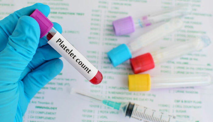 Low Platelet Count – Ways to Manage the Condition