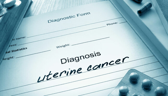 Uterine Cancer – Its Causes, Symptoms, and Stages