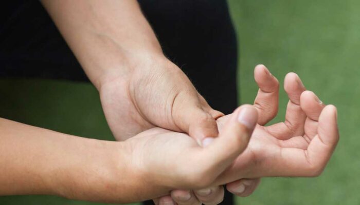 An Overview of Dupuytren’s Disease