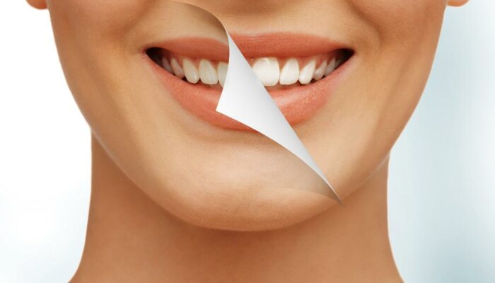 Bad Oral Health Habits You Should Avoid