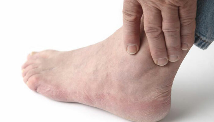 Here’s how to deal with the different causes of tingling