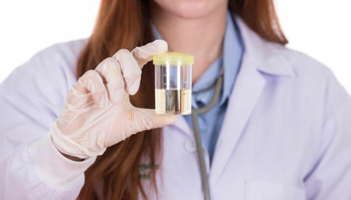 Here’s what you need to know about e coli in urine