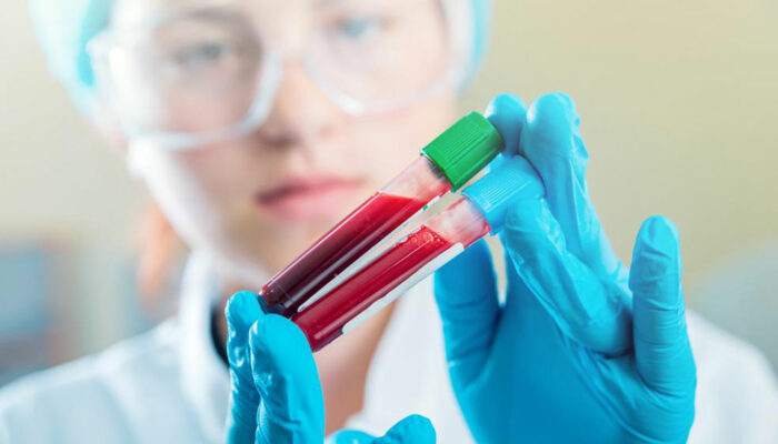 Here’s why maintaining normal creatinine levels is imperative