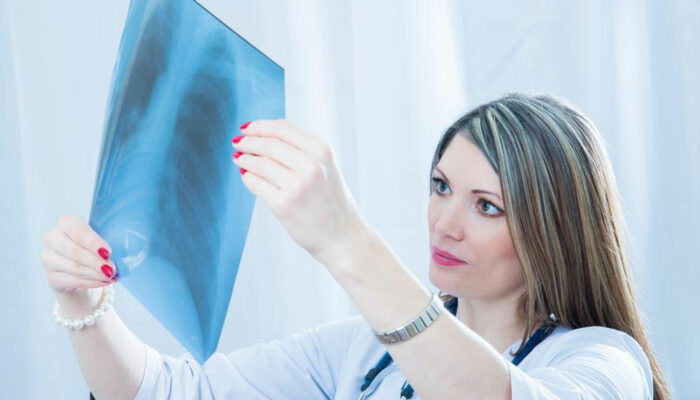 Pneumonia – Causes, signs and treatments