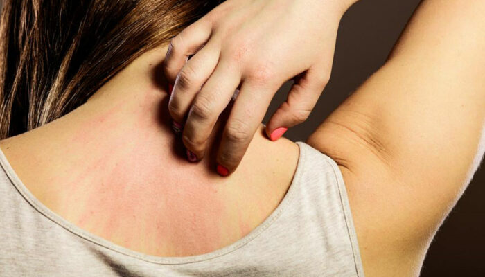 Seasonal allergies – An overview