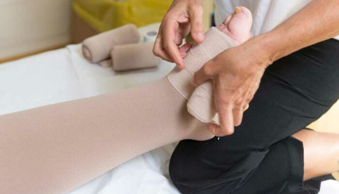 Swollen Legs – Causes and Remedies