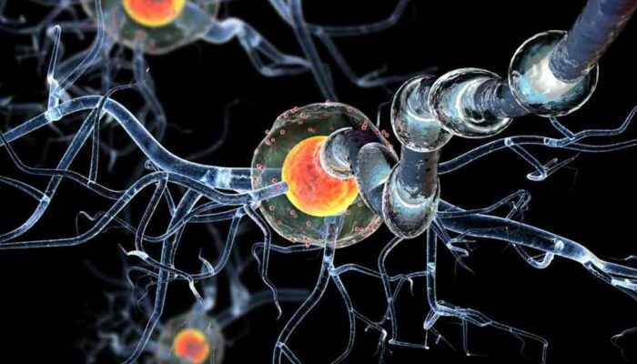 A Few Things to Know about Huntington’s Disease