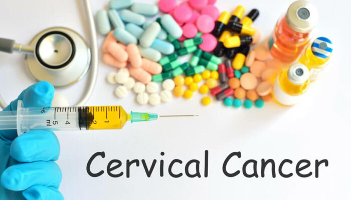 Do You Have Any of These Cervical Cancer Symptoms?