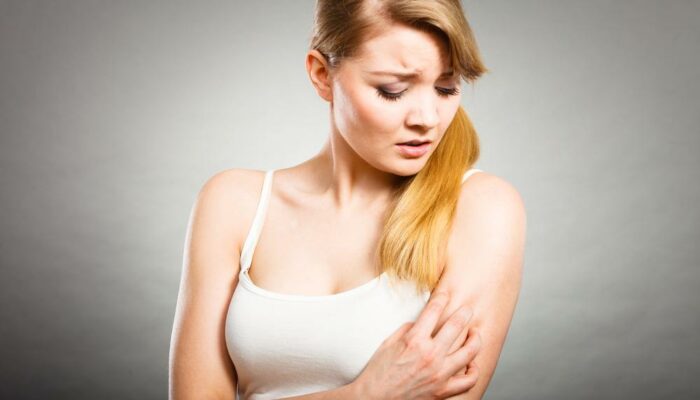 Here’s Everything You Need To Know About Psoriasis