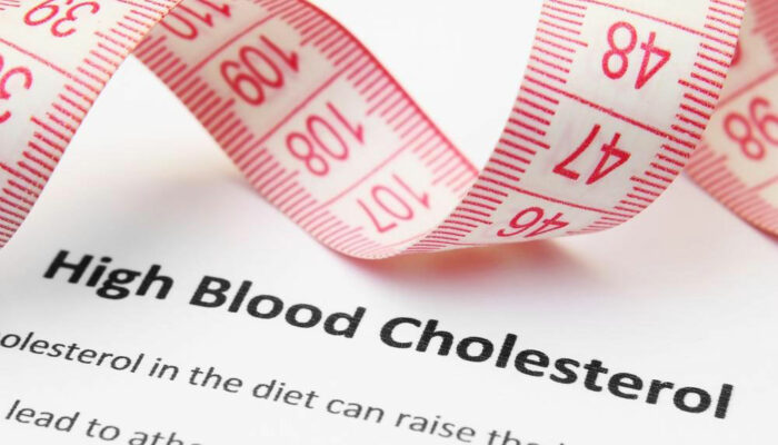 High Cholesterol – Symptoms and Treatment Options