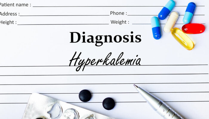 Hyperkalemia – Symptoms, causes, and treatments