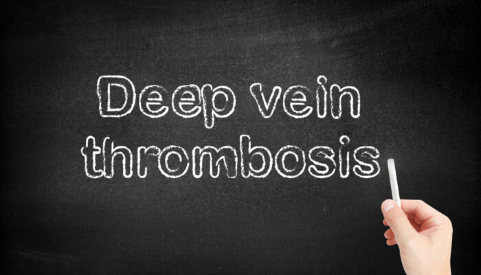 Simple tips to manage and ensure deep vein thrombosis prevention
