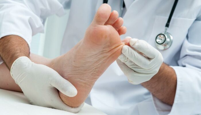 The Best Toenail Fungus Treatment Options For Quick Relief