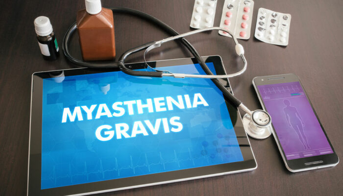 Myasthenia Gravis – Causes, Symptoms, and Prevention Methods