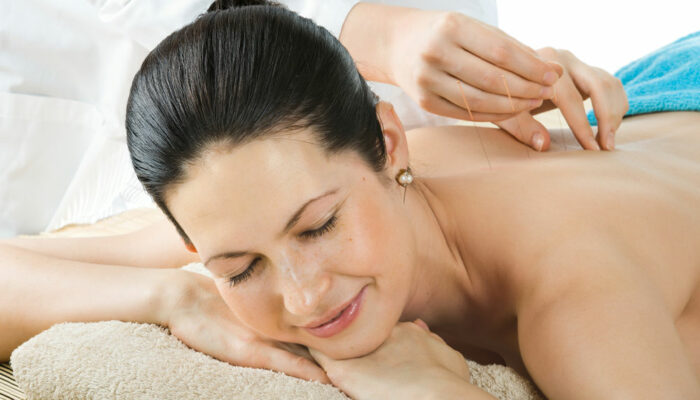 Acupuncture for Arthritis – Benefits, Cost, and More