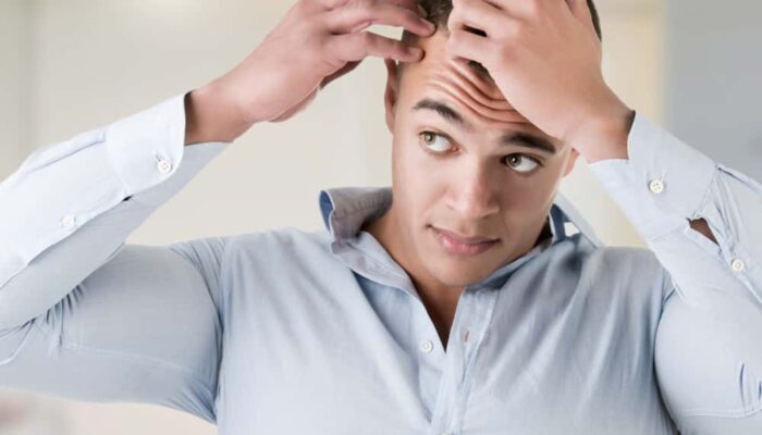 Hair Transplant – Procedure, Cost, and Factors to Consider