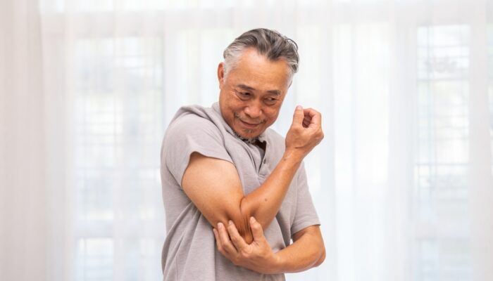 Understanding Psoriasis in the Elderly Recognizing and Managing Plaque Psoriasis